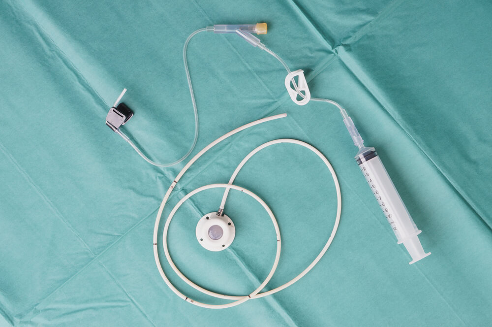 Angiodynamics-Port-Catheter-Lawsuit