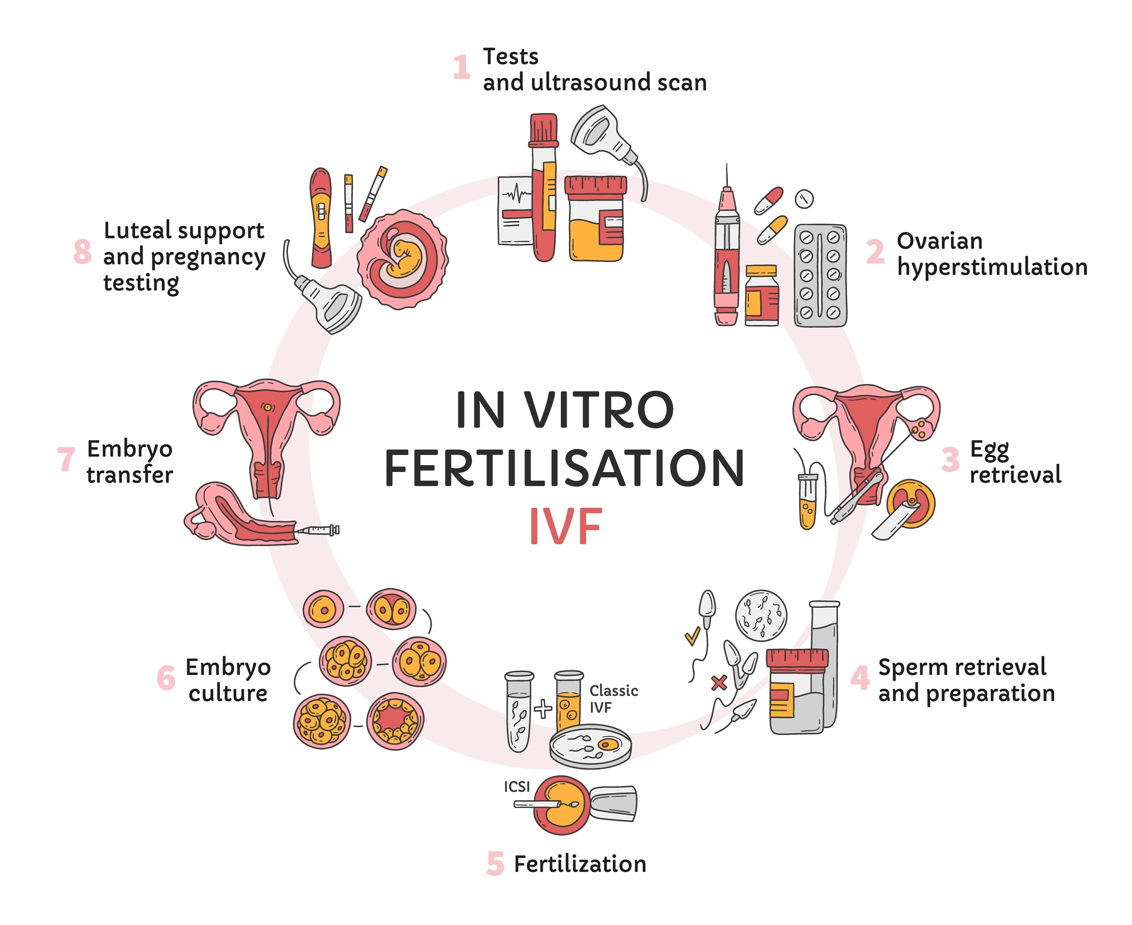 How-does-IVF-work