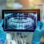 Lawsuit Claims AGGA Device Damaged Teeth, Resulting in Disfiguring Injury