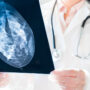 BioZorb Lawsuit Alleges Breast Tissue Marker Failed, Requiring Surgical Removal